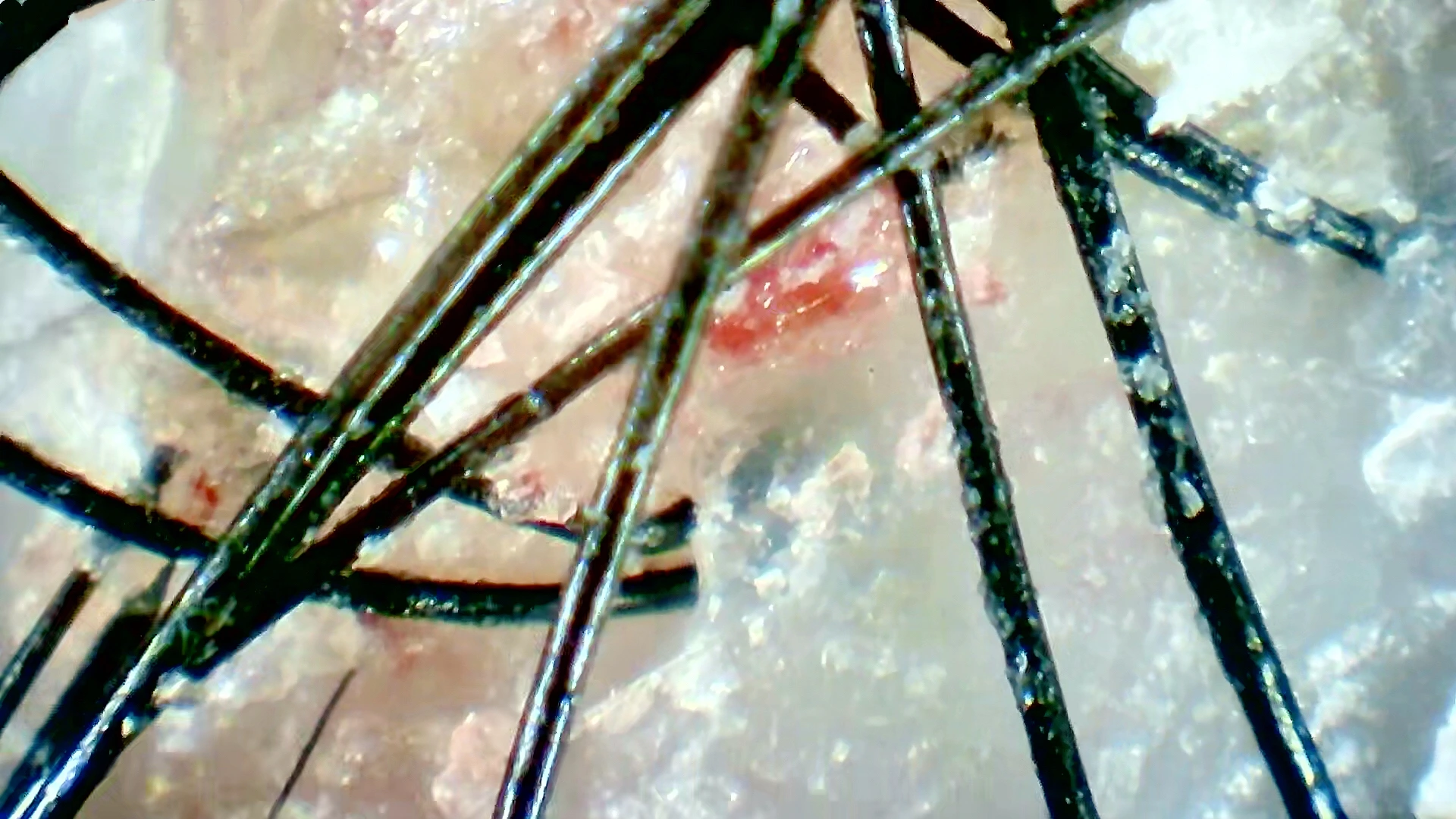 Scalp Treatment(Before)